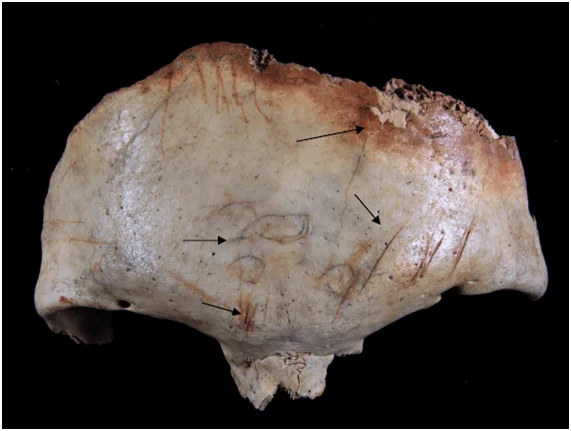 Figure 4. Frontal bone with signs of skinning, percussion marks, cooking and burning. Source: Solari Giachino, 2010: 211.