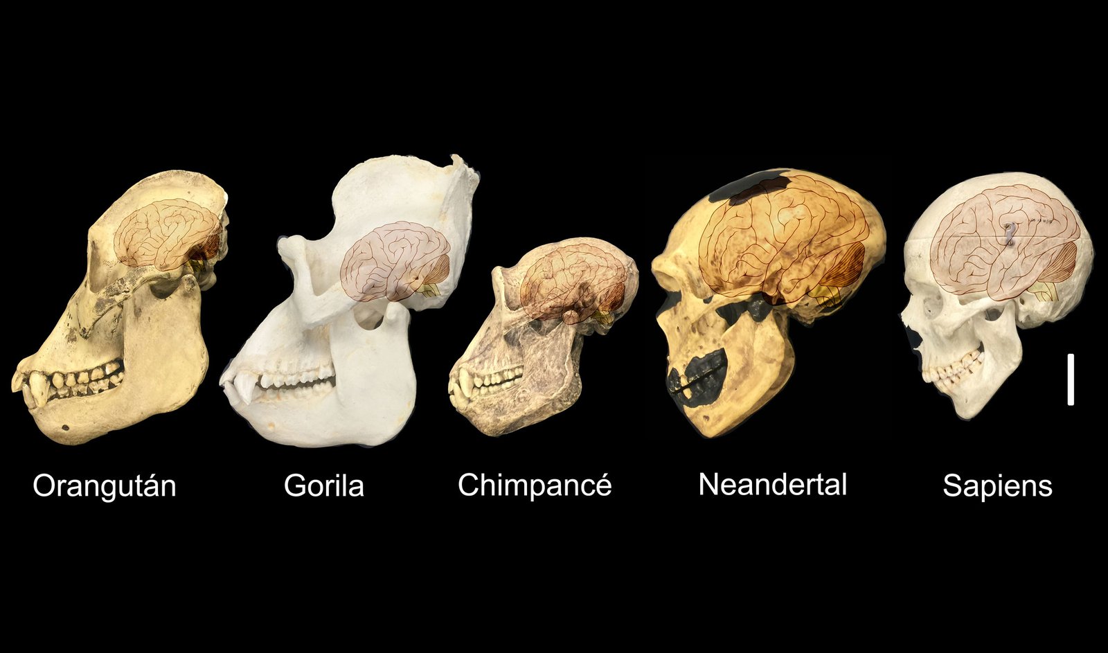 Humanos&#8230; y cabezones. Un cerebro moldeado por la alimentación durante miles de años.